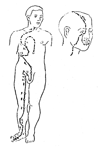   XII