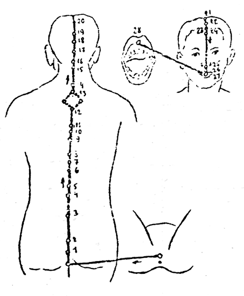   XIV