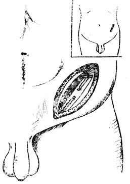 . 8.      (v. testicularis)   (  -  )