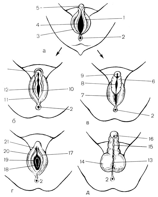 Рис. 8. Схема дифференцировки наружных половых органов плода (слева - девочка, справа - мальчик). а - 2-3 мес; б-в - 3-4 мес; г-д - в момент рождения; f - половая складка; 2 - анус; 3 - половой валик; 4 - половая щель; 5 - половой бугорок; 6 - уретральная складка; 7 - мошоночный валик; 8 - уретральная щель; 9 - половой отросток; 10 - складка внутренней половой губы; 11 - валик наружной половой губы; 12 - вульварная щель; 13 - шов мошонки; 14 - мошонка; 15 - уретральный шов; 16 - половой член; 17 - малая половая губа; 18 - вход во влагалище; 19 - отверстие уретры; 20 - большая половая губа; 21 - клитор