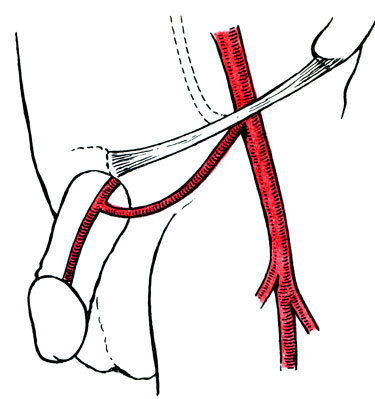 Рис. 63. Схема реваскуляризации артерий полового члена