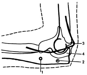 . 3.            . 1 -         ; 2 -         (  ,    ); 3 - n. ulnaris; 4 - cavum articularis