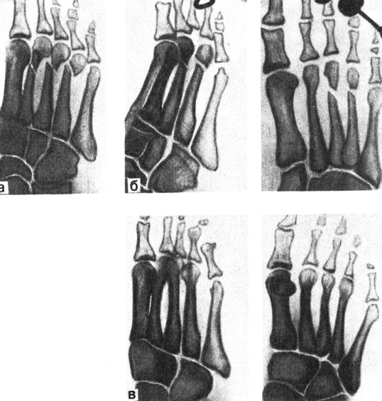 . 65.     ., 21 . :    II-III-IV        .  -  ;  -  ;  -  2   