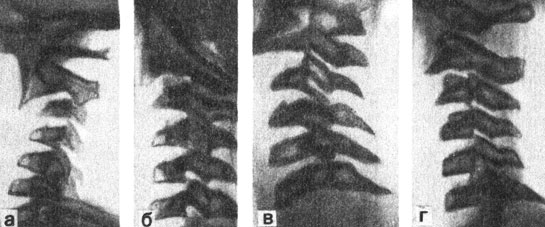. 79.   ., 18 . :   ><sub>II</sub>.  -  ;    -  ;  -  