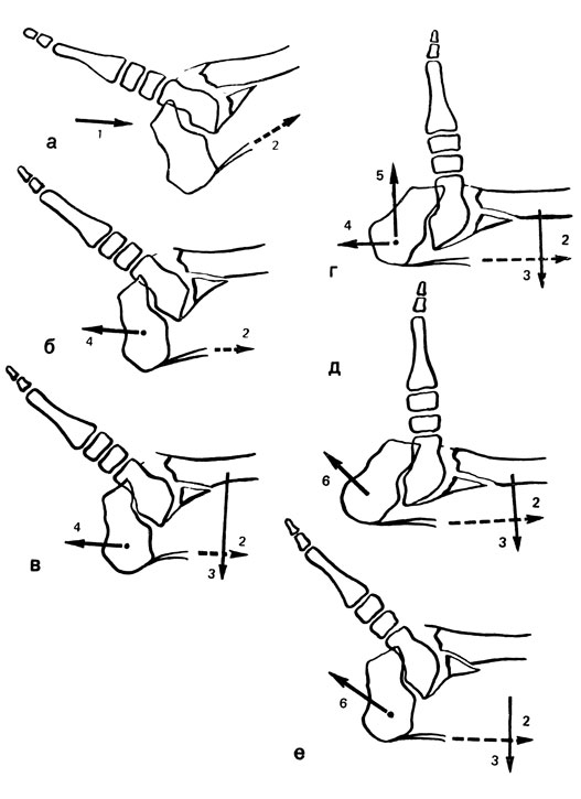 . 59.                  .  -    -    ; 1 -      ; 2 -   ;  -        (4) -    ;  -        (4)       (3);  -       (5)  ,     ( Matti - );  -    45    (6)       (3);  -           1-  