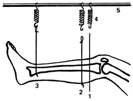 . 82.            . 1 -  ; 2 -       ; 3 -     ; 4 - ; 5 -  